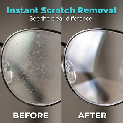 Lens Revive Scratch Repair Spray ( BUY 1 GET 1 FREE )